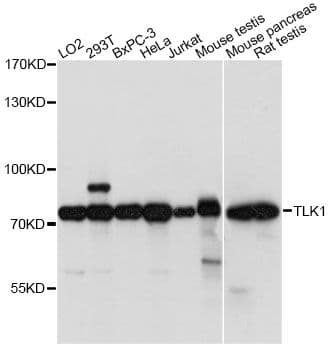 TLK1 Antibody