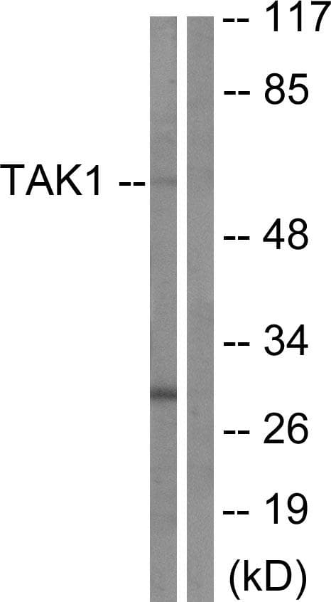 MAP3K7 / TAK1 Antibody (p184)