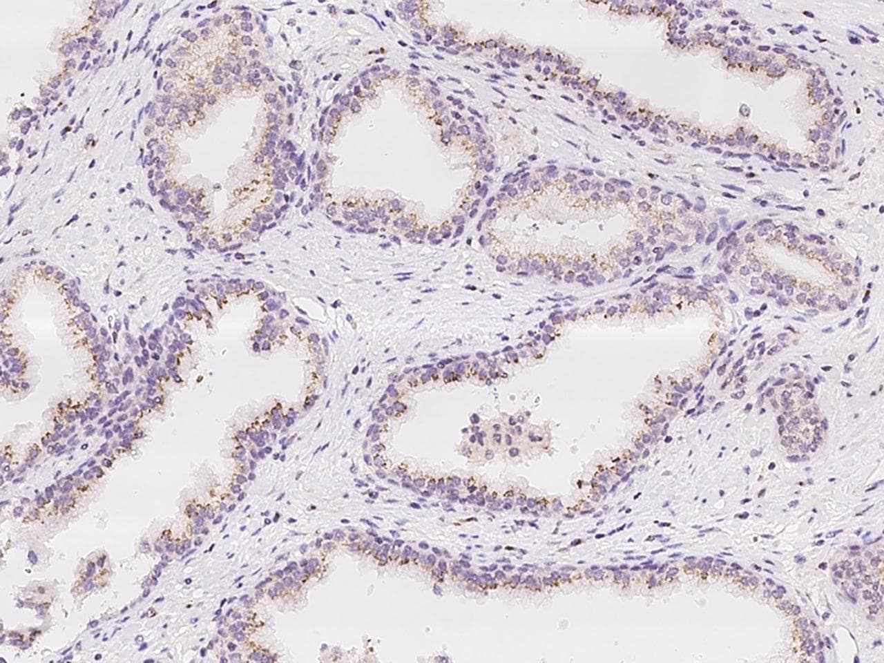 MAN1A2 Antibody