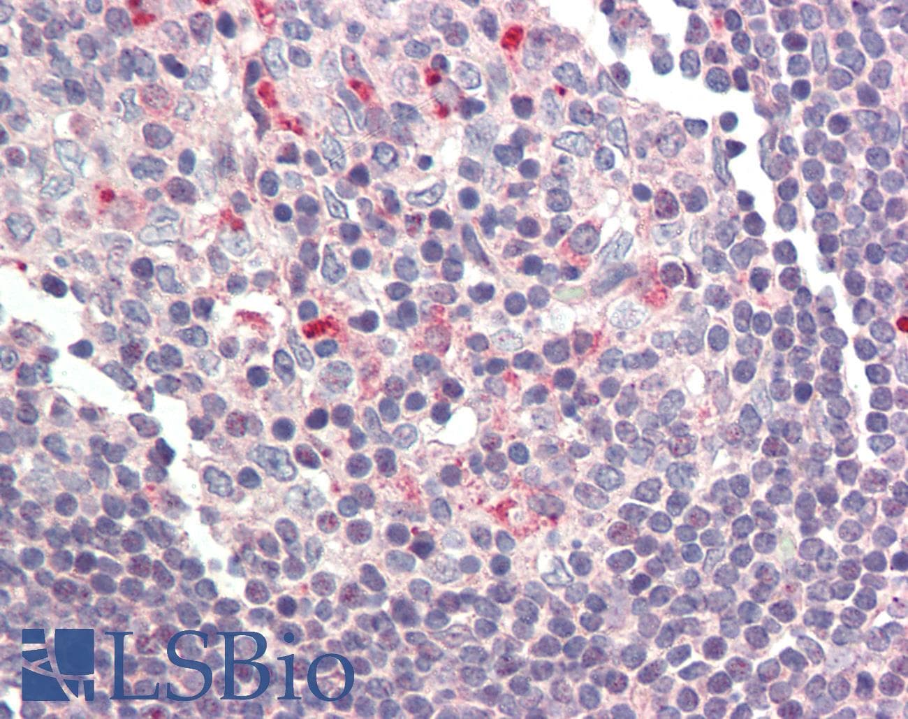 IHC-plus™ BCL2A1 Antibody
