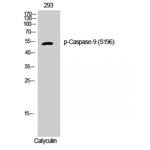 Polyclonal Rabbit anti-Human CASP9 / Caspase 9 Antibody (140-220 aa, IHC, WB)