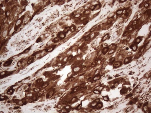 MLANA / Melan-A Antibody (aa48-118, clone OTI2E7)