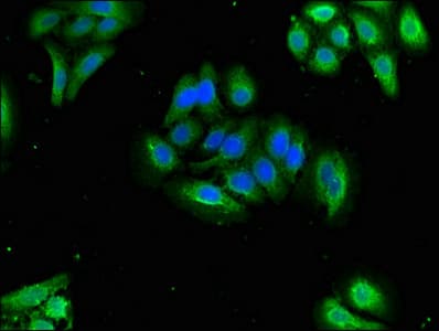 Polyclonal Rabbit anti-Human Oxytocin Antibody (IHC, IF, WB)