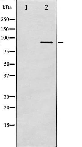 IKBKB / IKK2 / IKK Beta Antibody (phospho-Tyr188)