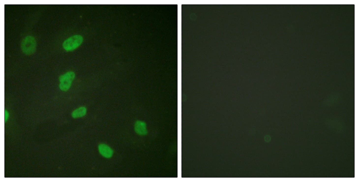Histone H2B Antibody (Acetyl-Lys5)