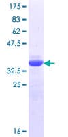 Human CRTC1 / MECT1 / TORC1 Protein (Recombinant GST, N-terminus)