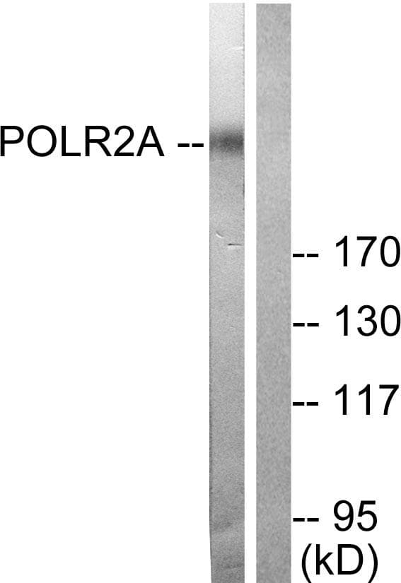 POLR2A / RNA polymerase II Antibody (p1619)