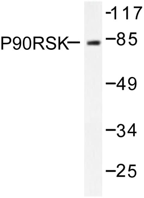 RPS6KA1 / RSK1 Antibody (Gln374)