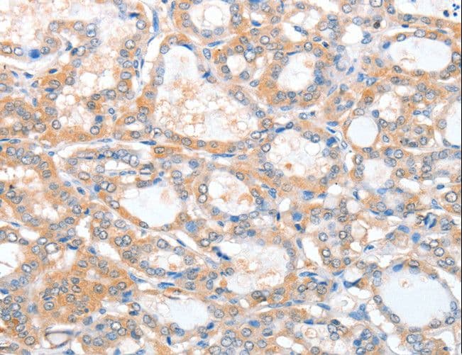 ACY3 Antibody