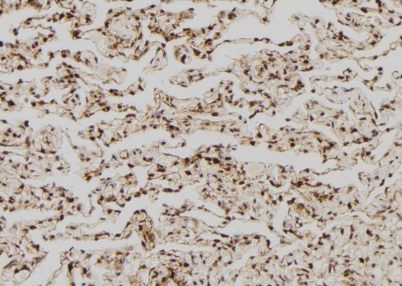 Polyclonal Rabbit anti-Human FASLG / Fas Ligand Antibody (IHC, WB)