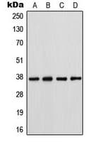 Polyclonal Rabbit anti-Human GJA4 / CX37 / Connexin 37 Antibody (Internal, WB)