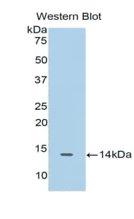 CDK2 Antibody (aa94-198, APC)