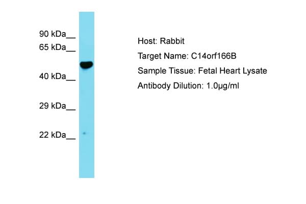 Polyclonal Rabbit anti-Human LRRC74A Antibody (aa26-75, WB)