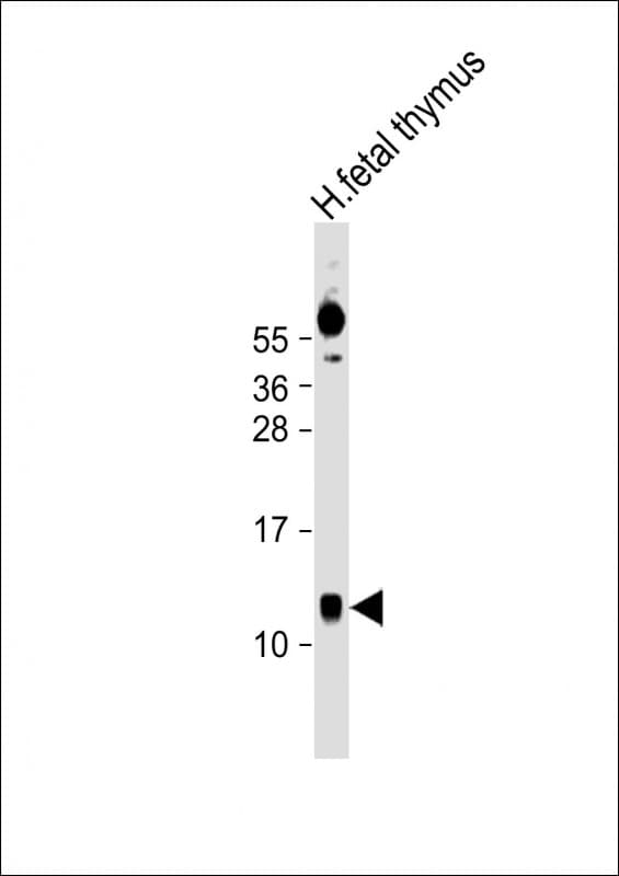 AHSP / EDRF Antibody (Internal)