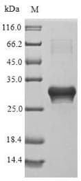 Parietaria judaica Par j 2.0101 Protein (Recombinant 6His-SUMO, N-terminus)