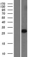BAP29 / BCAP29 Protein (Over-Expression Lysate Myc-DDK (Flag))