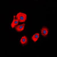 Polyclonal Rabbit anti-Human SERPINB5 / Maspin Antibody (Internal, IHC, IF, WB)