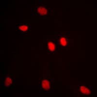 ADAR2 / ADARB1 Antibody (Internal)