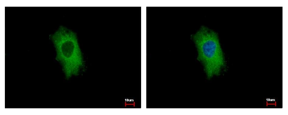 IHC-plus™ Polyclonal Rabbit anti-Human FSP27 / CIDEC Antibody (IHC, IF, WB)