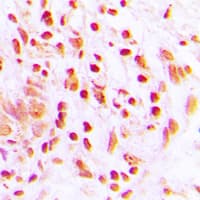 Histone H4 Antibody (Acetyl-Lys16)