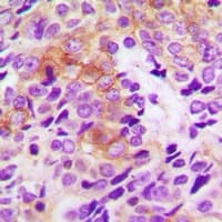 TK1 / TK / Thymidine Kinase Antibody