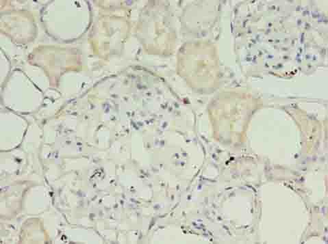 TIMM10B / FXC1 Antibody