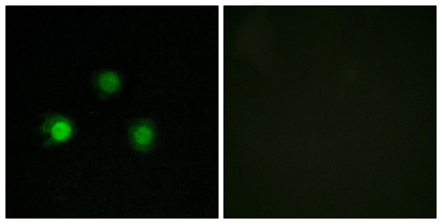 MSH2 Antibody