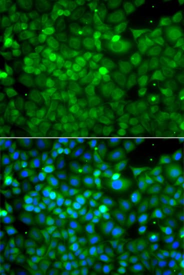 Polyclonal Rabbit anti-Human POC1A / SOFT Antibody (IHC, IF, WB)