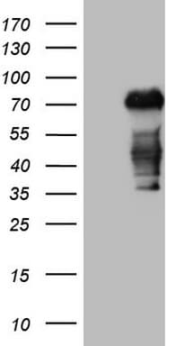 Monoclonal Mouse anti-Human CSF1 / MCSF Antibody (clone OTI1F8, aa223-496, WB)