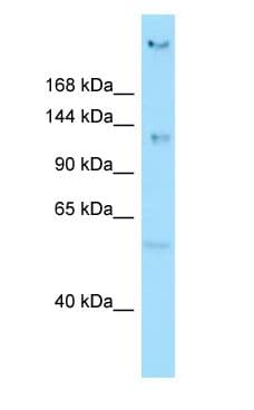 Polyclonal Rabbit anti-Human CEP135 Antibody (aa93-142, WB)