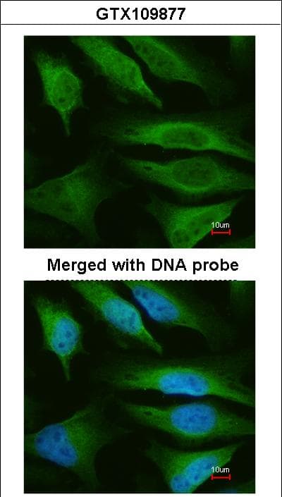 IHC-plus™ FH / Fumarase / MCL Antibody (aa195-473)
