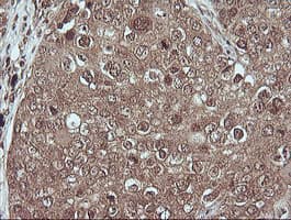 MAP2K1 / MKK1 / MEK1 Antibody (clone OTI2H3, Carrier-free)