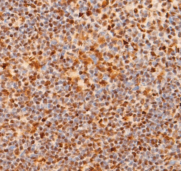 NOTCH1 Antibody (Cleaved Val1744)