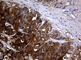 NME1 / NM23 Antibody (clone OTI2D8)