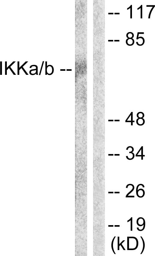 Polyclonal Rabbit anti-Human IKK Alpha+Beta Antibody (Internal, IHC, WB)