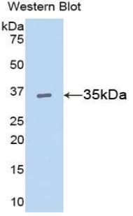 CCND1 / Cyclin D1 Antibody (aa1-295, Biotin)