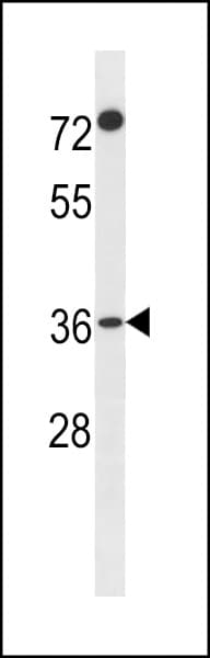 Polyclonal Rabbit anti-Human FAM110A Antibody (aa23-52, WB)