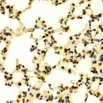 Histone H3 Antibody (Tri-Methyl-Lys9)