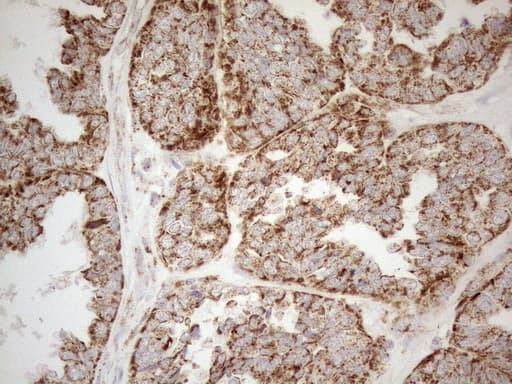 NAPSA / NAPA / Napsin A Antibody (aa64-244, clone OTI3E5)
