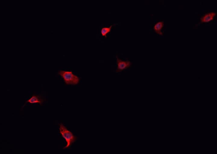 ABCG8 Antibody