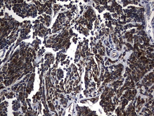 Monoclonal Mouse anti-Human NME1 / NM23 Antibody (clone UMAB92, IHC, IF, WB)