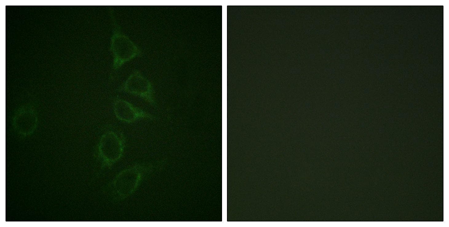 CALM1 / Calmodulin Antibody (phospho-Thr79+Ser81)