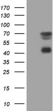 MSLN / Mesothelin Antibody (aa270-493, clone OTI3E10)