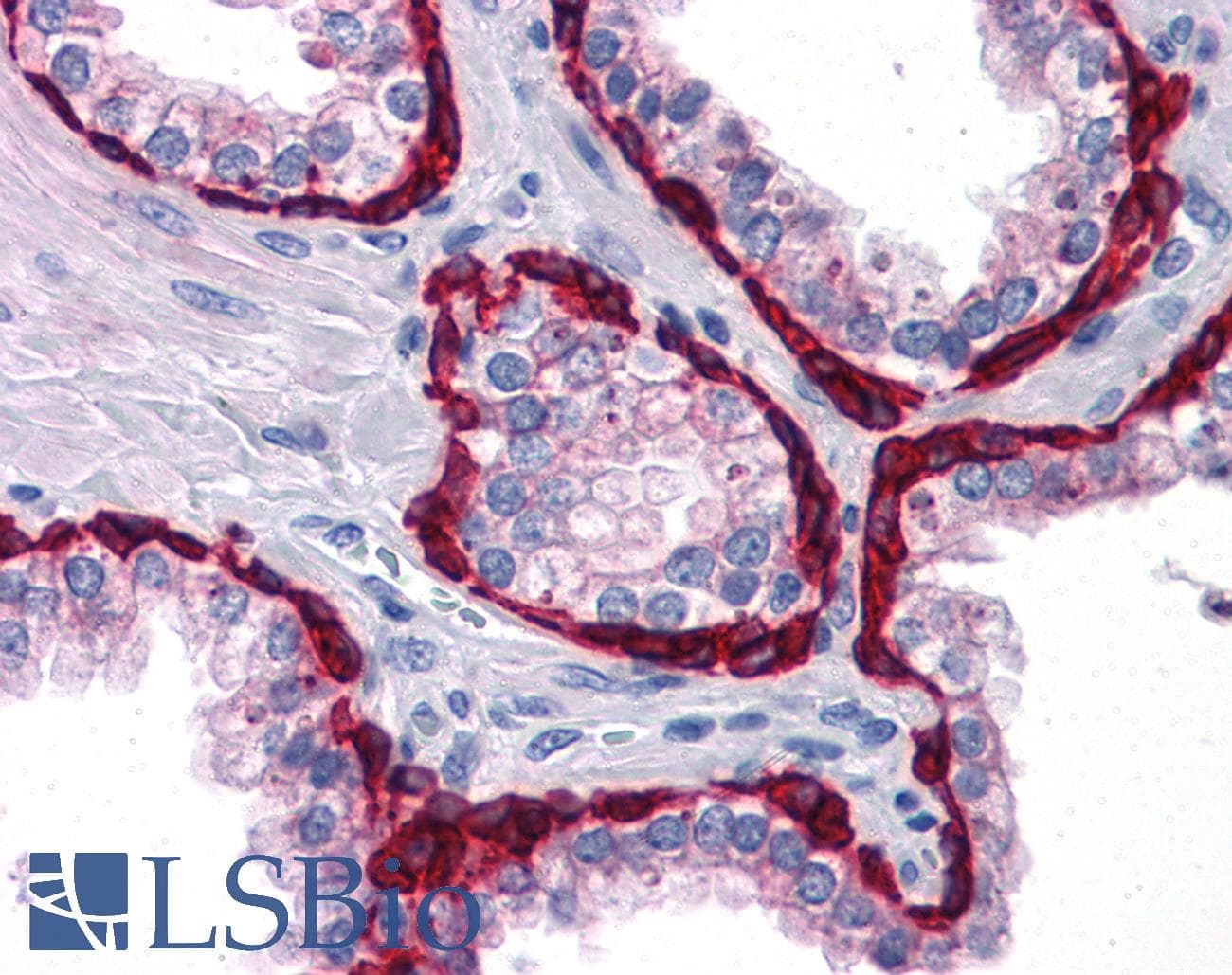 IHC-plus™ KRT15 / CK15 / Cytokeratin 15 Antibody (clone 6E7)