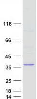 Human TATDN3 Protein (Recombinant Myc-DDK (Flag))