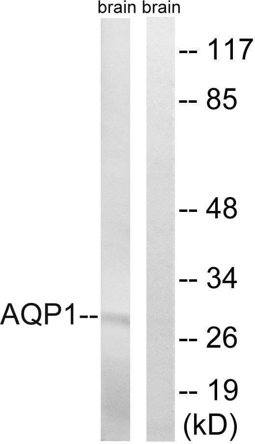 AQP1 / Aquaporin 1 Antibody