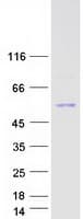 Human PNLIP / PL / Pancreatic Lipase Protein (Recombinant Myc-DDK (Flag))