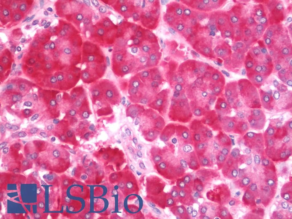 IHC-plus™ Polyclonal Rabbit anti-Human US01 / p115 Antibody (aa913-962, IHC, WB)