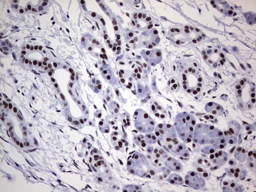 Monoclonal Mouse anti-Human PPP1R8 / Rnase E Antibody (clone OTI4E5, aa1-225, IHC, WB)