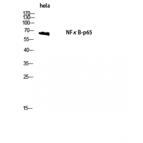 Polyclonal Rabbit anti-Human RELA / NFKB p65 Antibody (220-300 aa, IHC, WB)